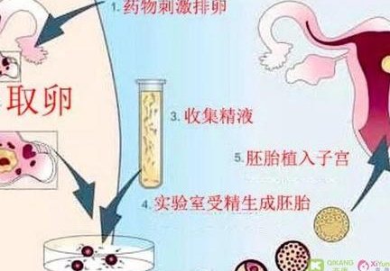 【河南安阳】安阳三代试管哪家医院更专业？看完这篇就明白