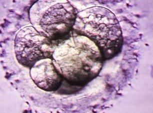 佛山顺德妇幼保健院做试管的成功率多少？一次能成功吗？